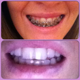 Dependancy Rehab Course of And 4 Phases Of Addiction Remedy